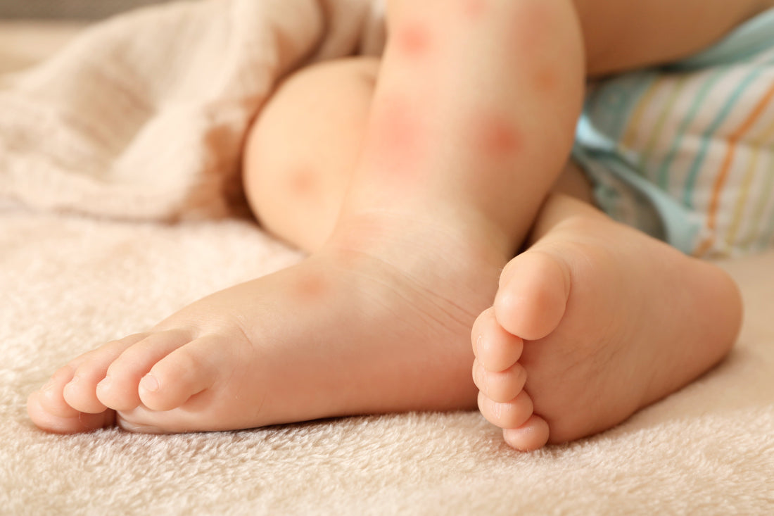 eczema_swimwear_kids_bamboo