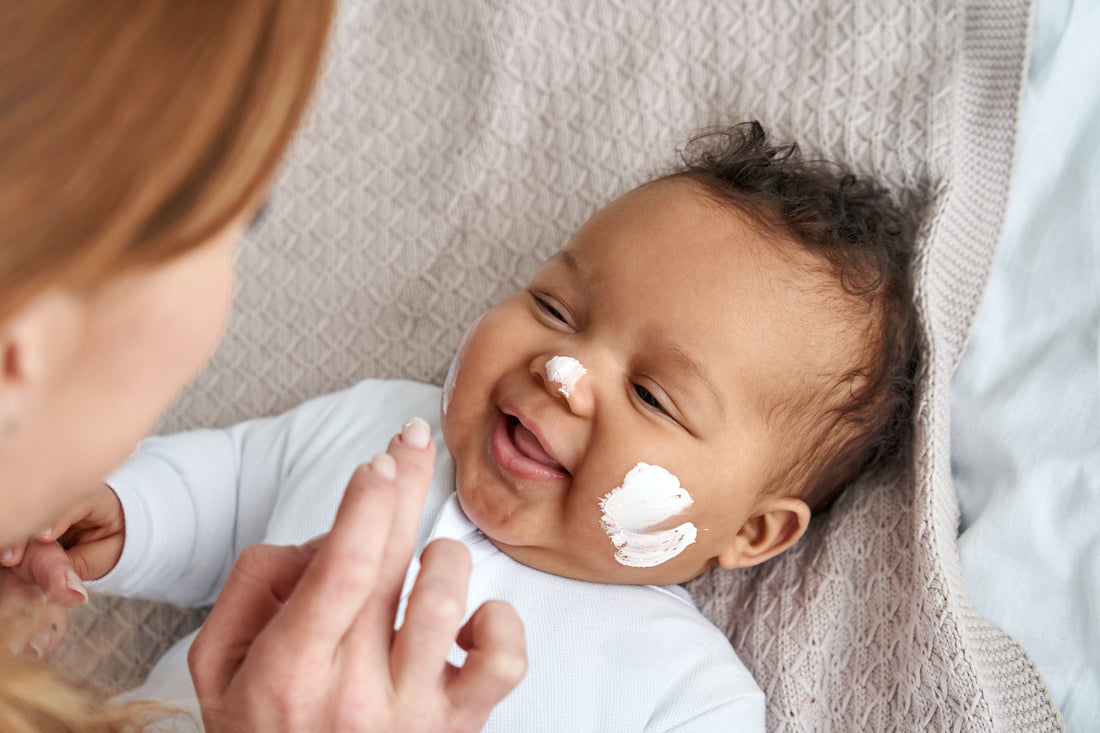 eczema_natural_treatments